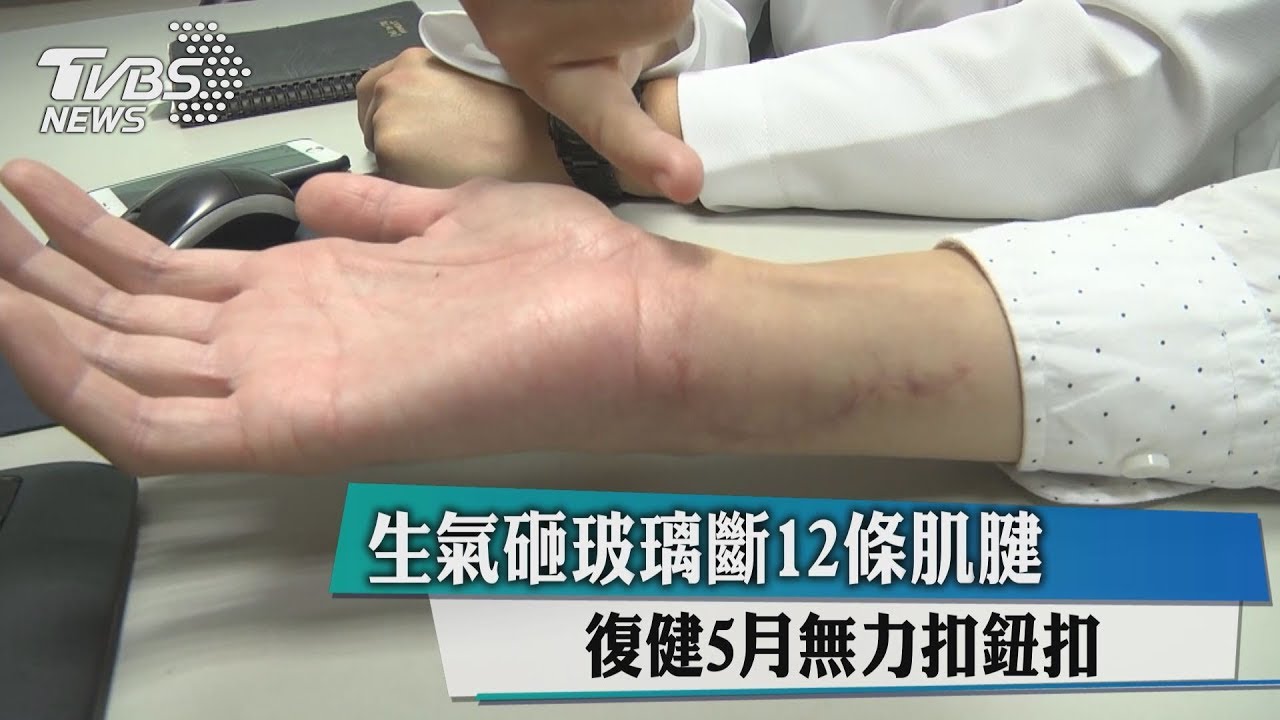 生氣砸玻璃斷12條肌腱　復健5月無力扣鈕扣