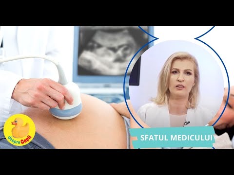 varicoza laser de perete unde o fac prevenirea varicoza