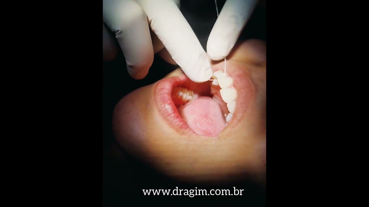 Gislene Isabel De Mendonça-16