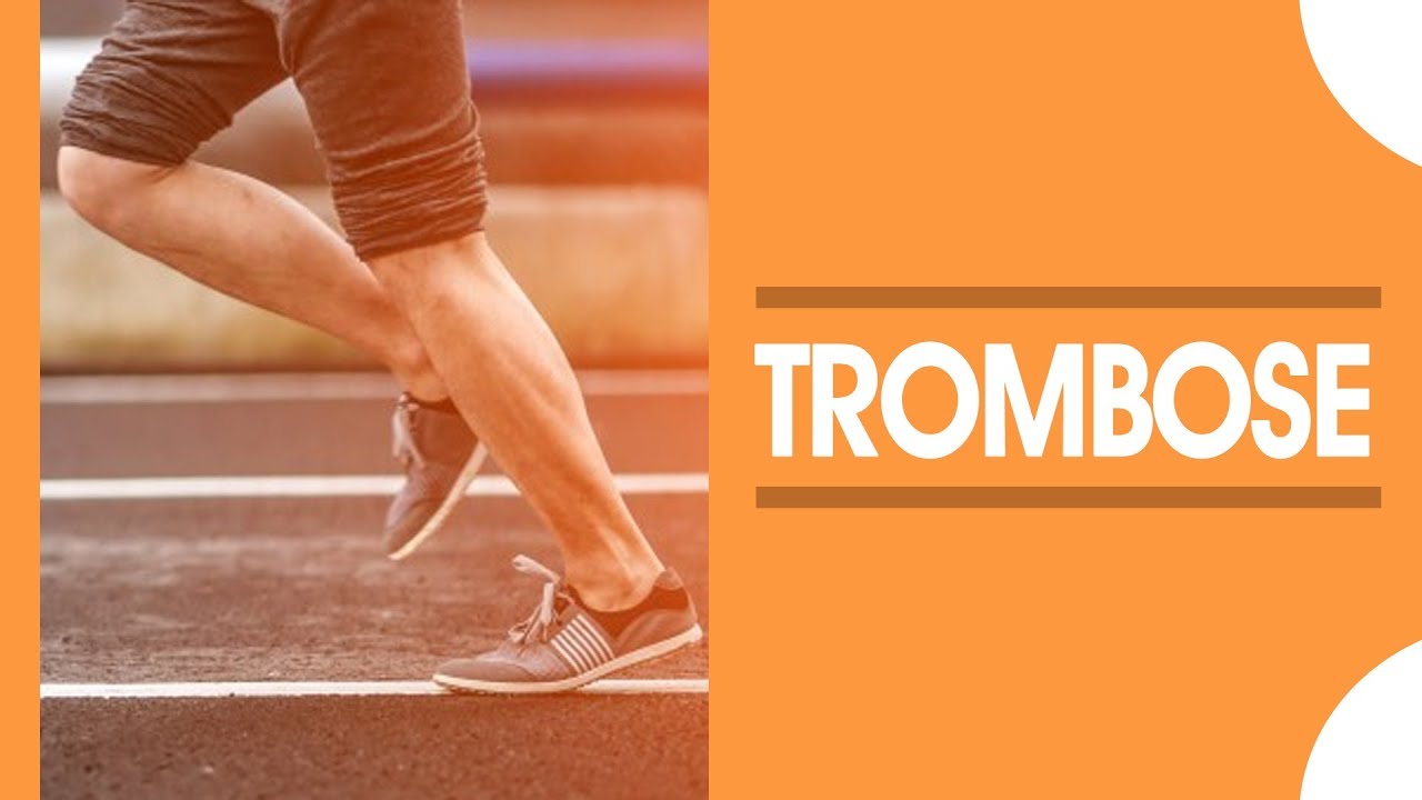 Trombose: causas e sintomas