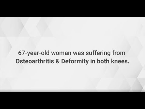 From Pain to Mobility: A Remarkable Transformation!