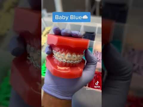 Braces colors you should be getting!🤩✨ #jeffersondental #braces #bracescolors #bestbraces