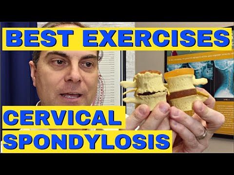 4 Best Exercises for Cervical Spondylosis | Dr. Walter Salubro Chiropractor in Vaughan ON