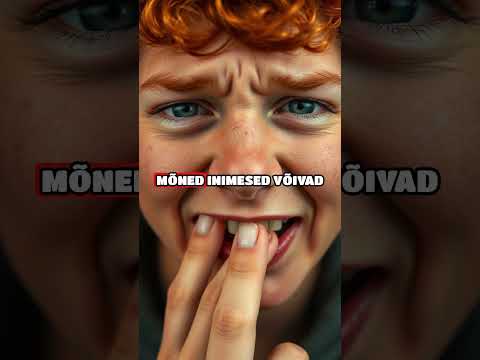 Särava Naeratuse Saladused | Hammaste Valgendamine #HammasteValgendamine