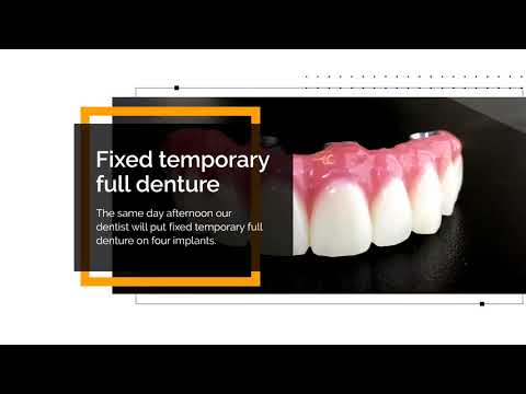 Full upper or lower denture on four implants - All ON 4 method