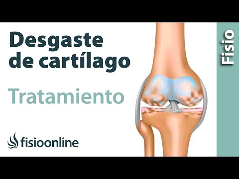 Edemul cu artroza genunchiului nu dispare
