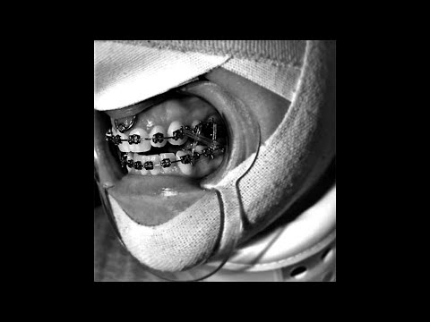 [FREE] Breakbeat x Electro Punk Type Beat - ‘ADRENALIN’