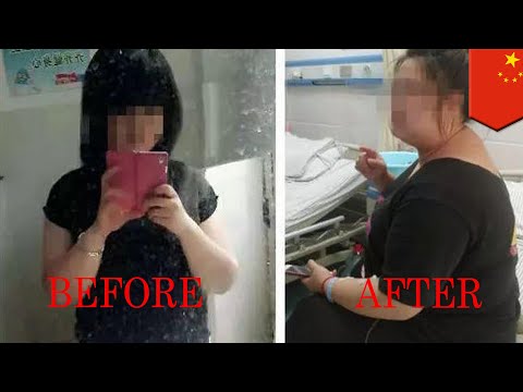 Setelah bea membagi-tipis Forum Yashkov semua menurunkan berat badan