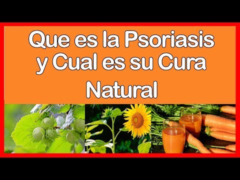 Los novísimos preparados a la psoriasis La psoriasis de la fase del tratamiento de la foto