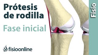 Rehabilitación de prótesis de rodilla - Primera fase