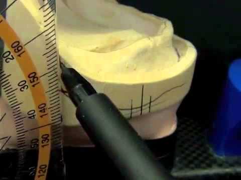 Merz Dental Modellanalyse Totalprothetik deutsch