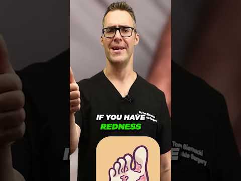 Best Wound Care Centers in Michigan Skin Diabetic Foot Ulcers