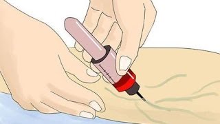 Ferritina y transferrina ¿Cómo se relacionan