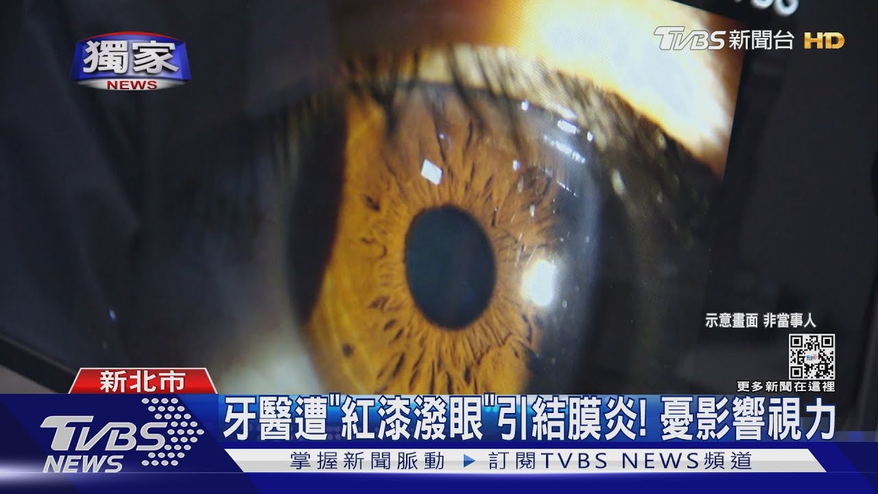 診所外被漆潑! 牙醫右眼「急性結膜炎」送醫