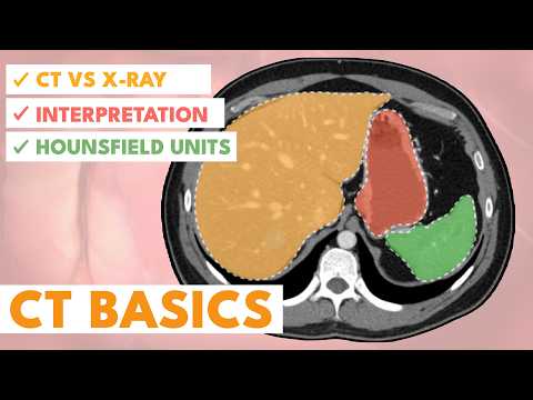 An introduction to CT scans (1/2) | A beginner's Guide