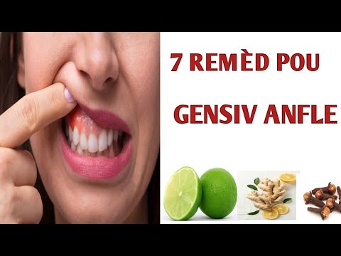 7 NATURAL REMEDIES FOR SWELLING GUMS