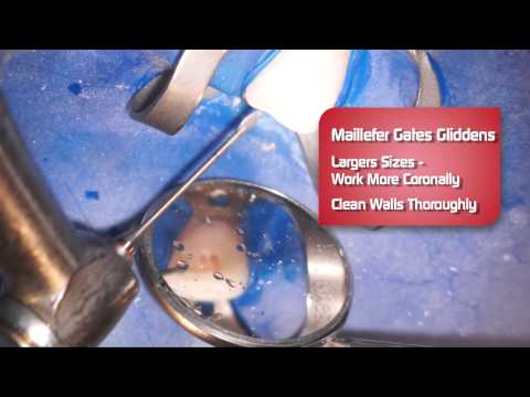 Gates Gliddens Bur - Review by Dr. Scott Norton