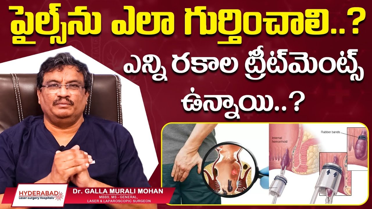 Piles Laser Treatment Video 2