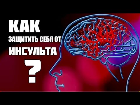 Профилактика инсульта с доктором Божьевым