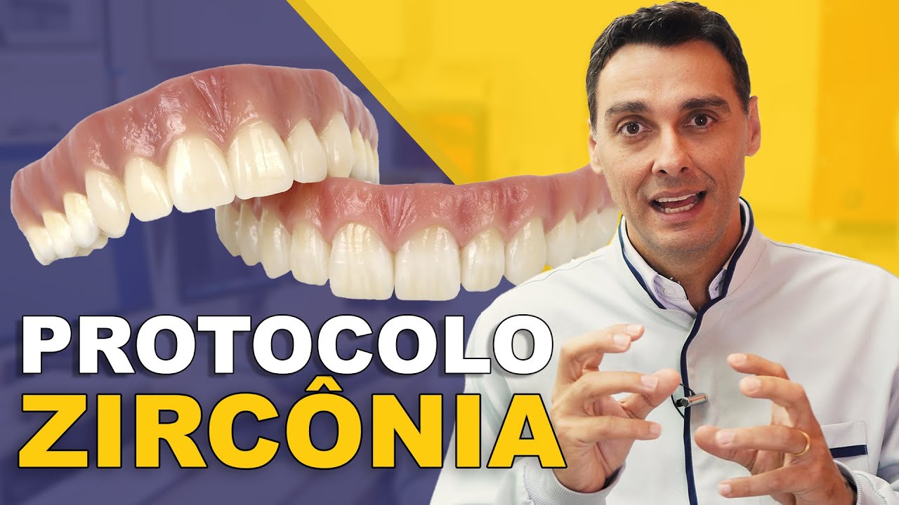 Prótese Protocolo de Zircônia: a Revolução da Prótese Fixada com Implantes.