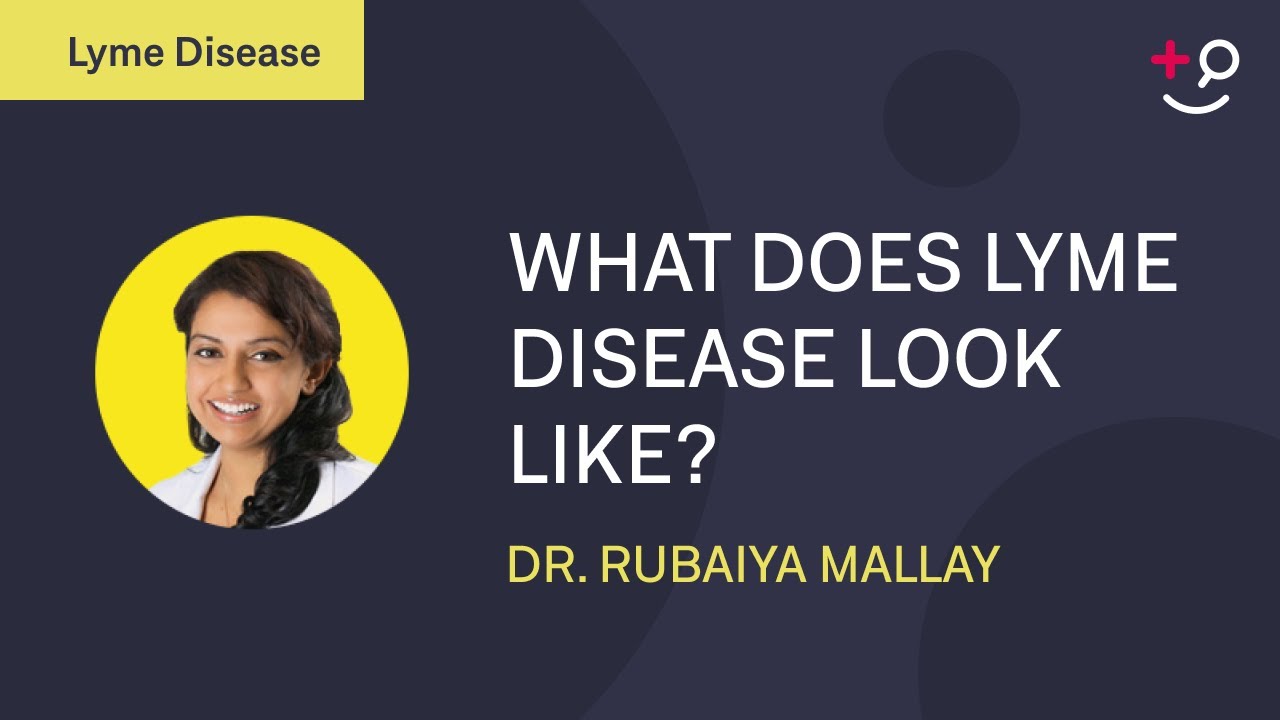 What Does Lyme Disease Look Like Signs and Symptoms of Lyme Disease