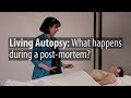 Living Autopsy What Happens During A Post Mortem Full Lecture