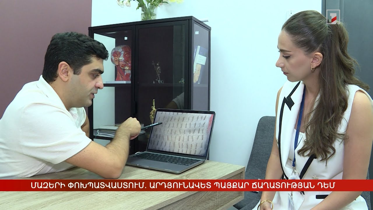 Մազերի փոխպատվաստում. արդյունավետ պայքար ճաղատության դեմ