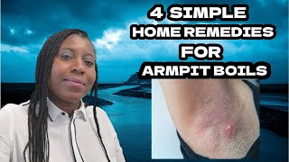 How to Get Rid of a Boil in the Armpit  4 Simple Natural Home Remedies