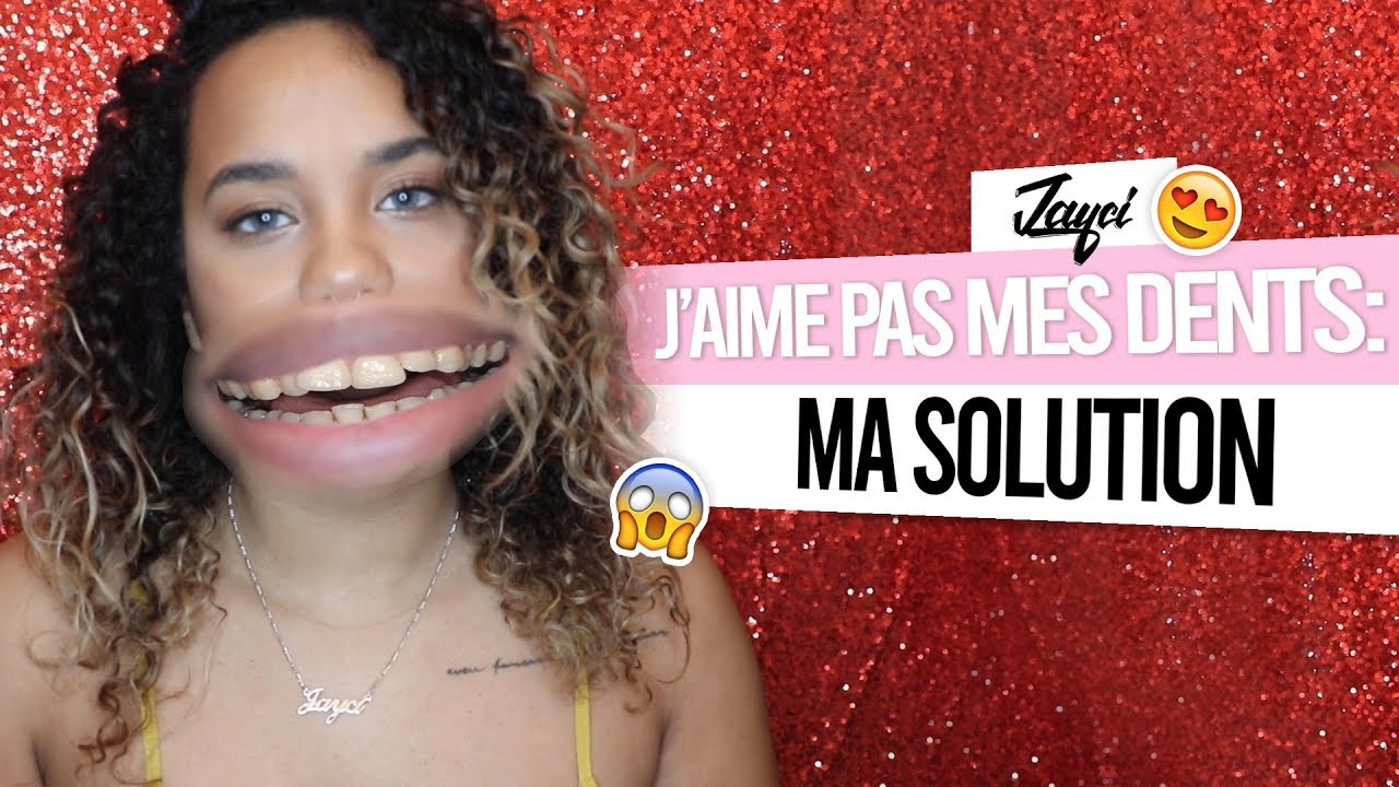 Watch video Jayci: J'aime pas mes dents: Ma solution ! Jayci: J'aime pas mes dents: Ma solution !