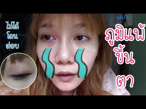 ทิงเจอร์ของโรคสะเก็ดเงิน veselok กลาก disgidroticheskoy ของมือ