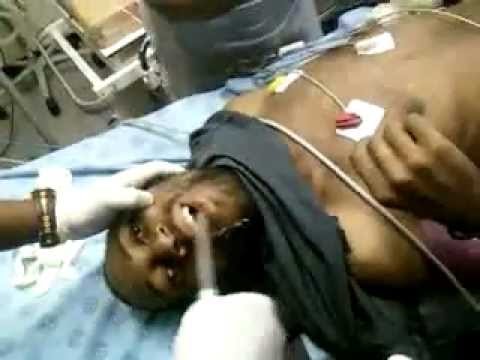 Доктори извадиха мобилен телефон от устата на мъж