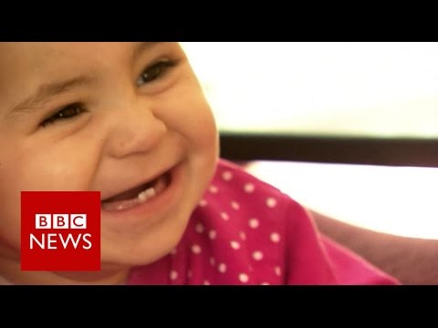UK surgeon returns to find injured Syrian baby - BBC News
