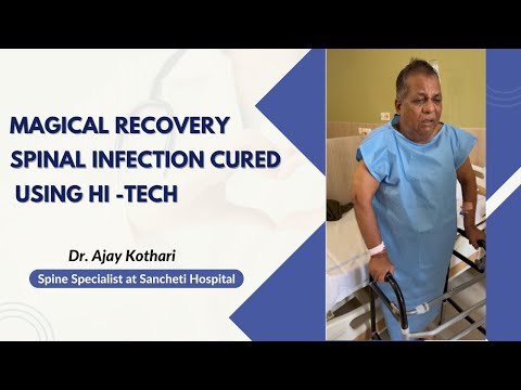 Patient Testimonials | Dr. Ajay Kothari - Spine Surgeon | Shivaji Nagar, Pune