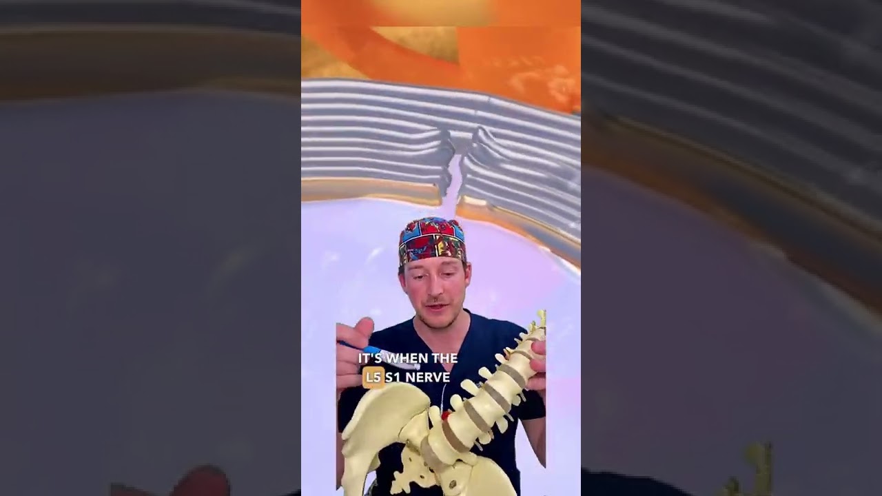 𝐑𝐚𝐝𝐢𝐜𝐮𝐥𝐨𝐩𝐚𝐭𝐡𝐲 𝐯𝐬 𝐒𝐜𝐢𝐚𝐭𝐢𝐜𝐚?! (𝚂𝚙𝚒𝚗𝚎 𝚂𝚞𝚛𝚐𝚎𝚘𝚗 𝙴𝚡𝚙𝚕𝚊𝚒𝚗𝚜)