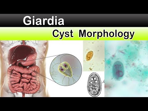 giardia unilab vérszegénység 2 év