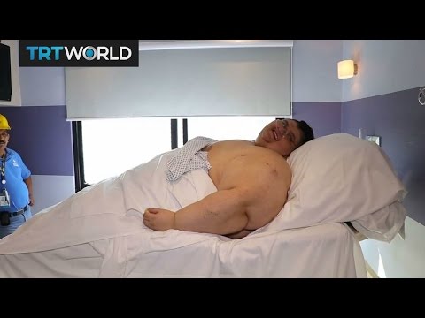 World's Heaviest Man: Juan Pedro Franco discharged after surgery