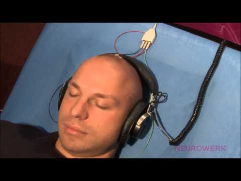 Evozierte Potentiale - FAEP