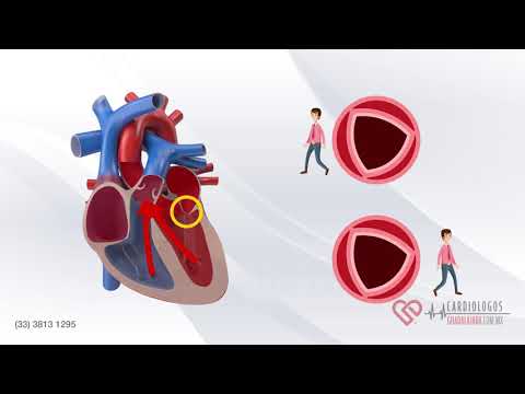 🩺Corazón Humano 💖