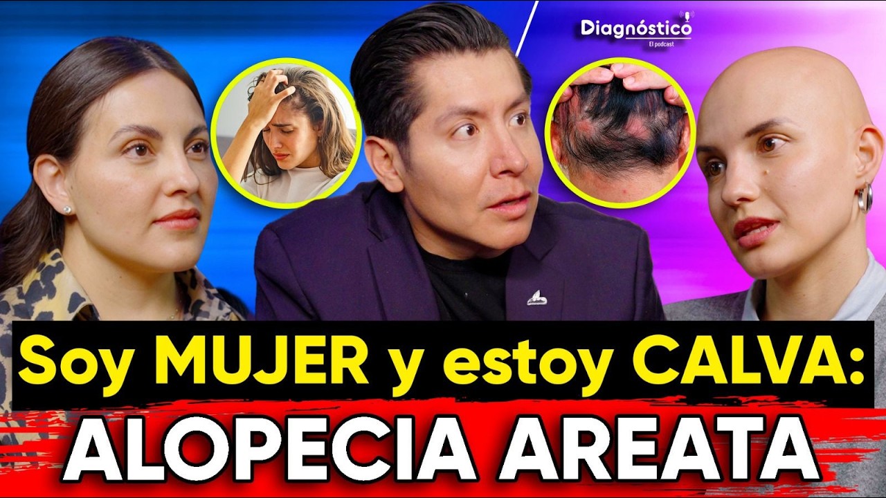 👉🏼ALOPECIA AREATA: Causas y TRATAMIENTO según DERMATÓLOGA ‼️ | #Diagnóstico 171 | Mr Doctor
