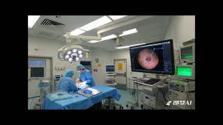 The world's first AI navigation system for TAVI surgery has been approved by the FDA