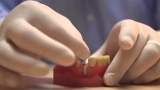 Mission Dental Health: Repairing a Broken Tooth