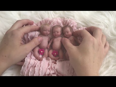 Remember the smallest triplets in the world? Here's what happened to them now