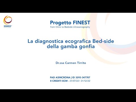 16. La diagnostica ecografica bed-side della «gamba gonfia»
