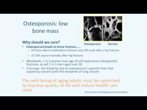 Bone Health: Dairy, Calcium and Beyond