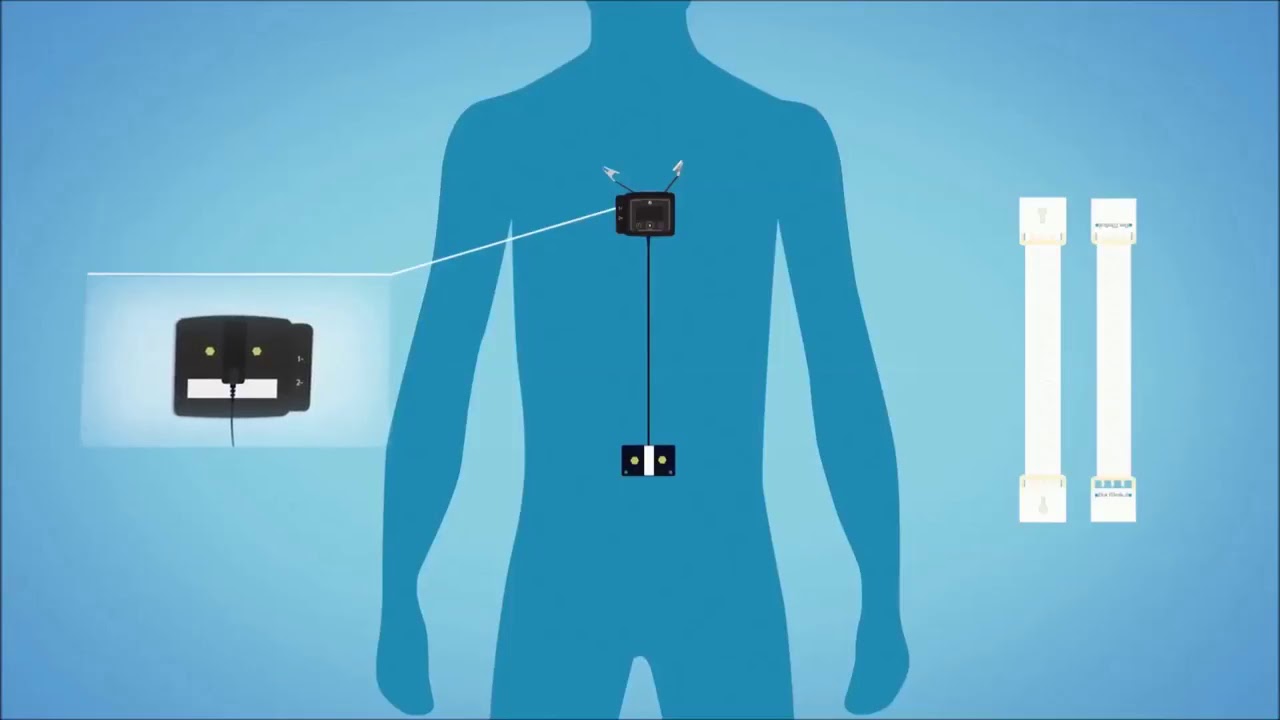 Vidéo d'instructions - Mise en place de l'appareil NOX T3