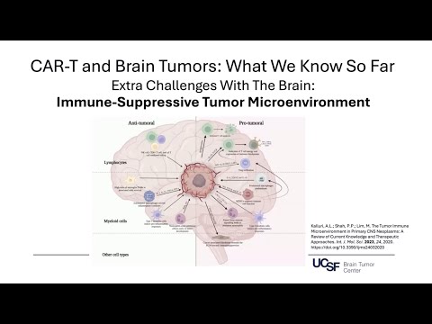 Immunotherapy for Brain Tumors: CAR-T Cell Therapy