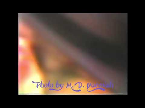 Rav Yaakov Kaminetzky visits Rav Moshe Feinstein ztz"l - The M.D. Yarmish Collection