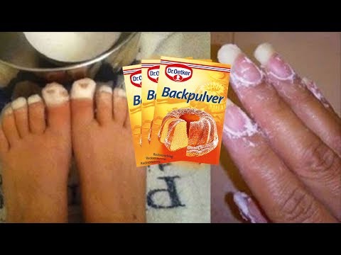 Die Folgen nicht die Behandlungen gribka der Nägel auf den Beinen Ob man gribok der Nägel das Gel lackieren kann