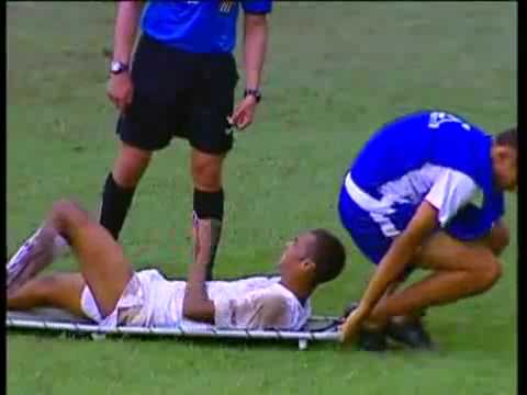 El camillero más torpe del mundo.flv