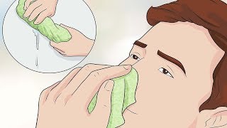 How To Heal Sores In The Nose Naturally |Top 5 Home Remedies for Cold Sores in the nose